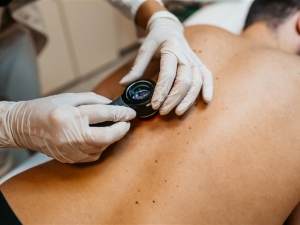 Skin Cancer Screenings